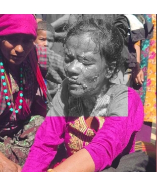 रोल्पामा प्रेसर कुकर पड्किँदा एक जना घाइते